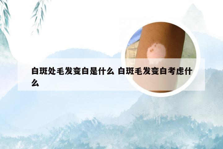 白斑处毛发变白是什么 白斑毛发变白考虑什么