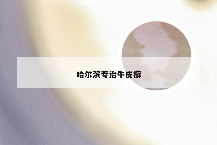 哈尔滨专治牛皮癣