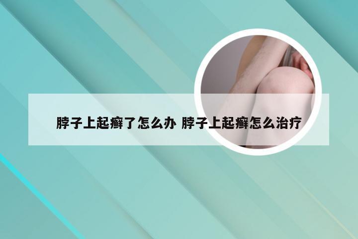 脖子上起癣了怎么办 脖子上起癣怎么治疗
