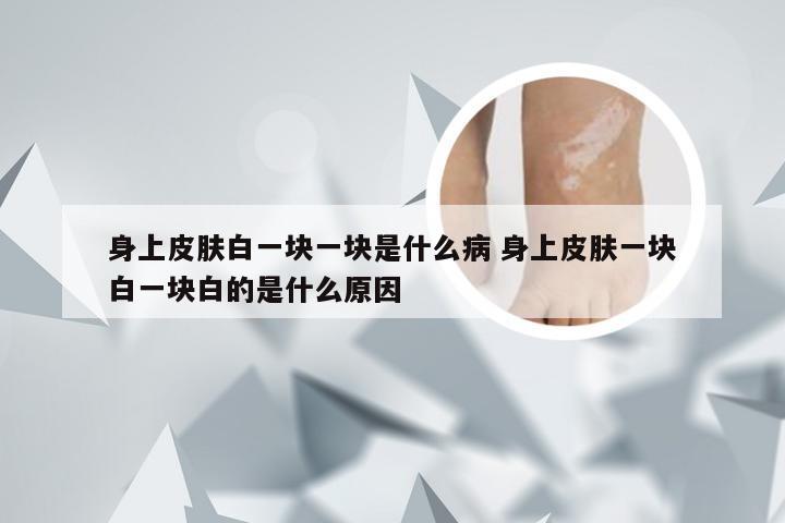 身上皮肤白一块一块是什么病 身上皮肤一块白一块白的是什么原因