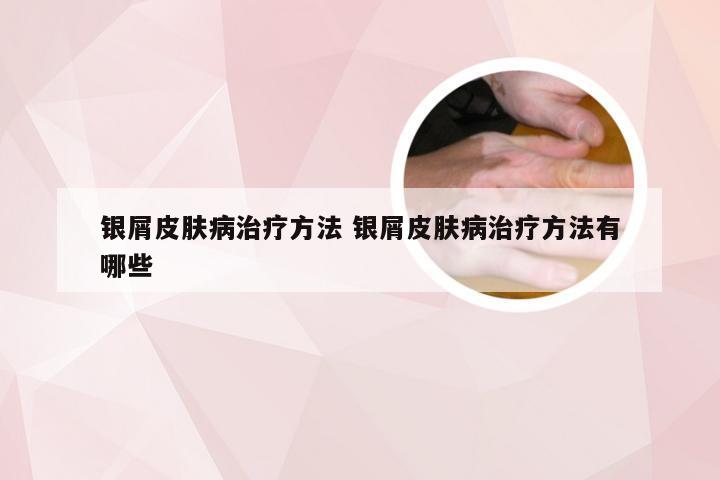 银屑皮肤病治疗方法 银屑皮肤病治疗方法有哪些