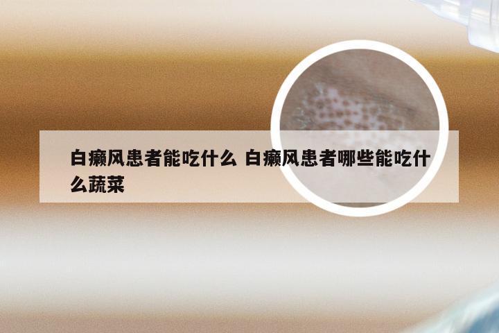 白癞风患者能吃什么 白癞风患者哪些能吃什么蔬菜