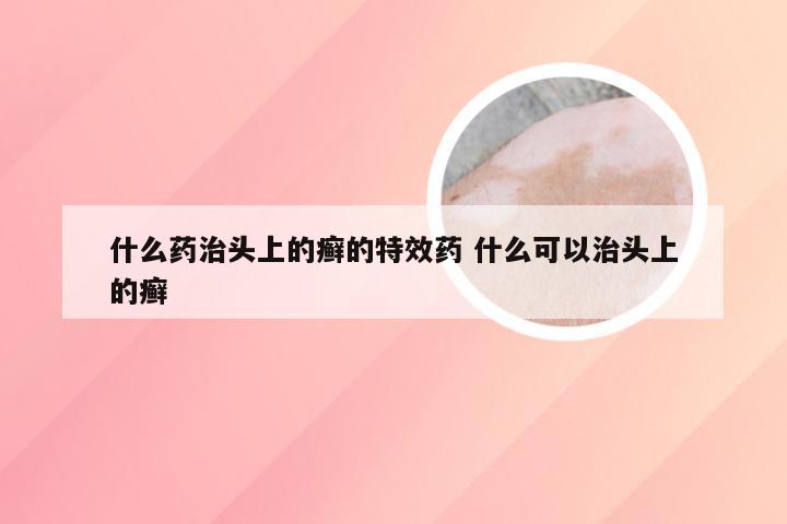 什么药治头上的癣的特效药 什么可以治头上的癣