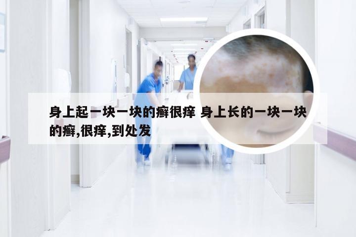 身上起一块一块的癣很痒 身上长的一块一块的癣,很痒,到处发
