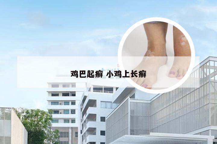 鸡巴起癣 小鸡上长癣