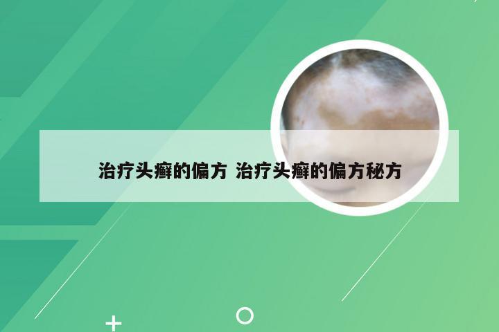 治疗头癣的偏方 治疗头癣的偏方秘方