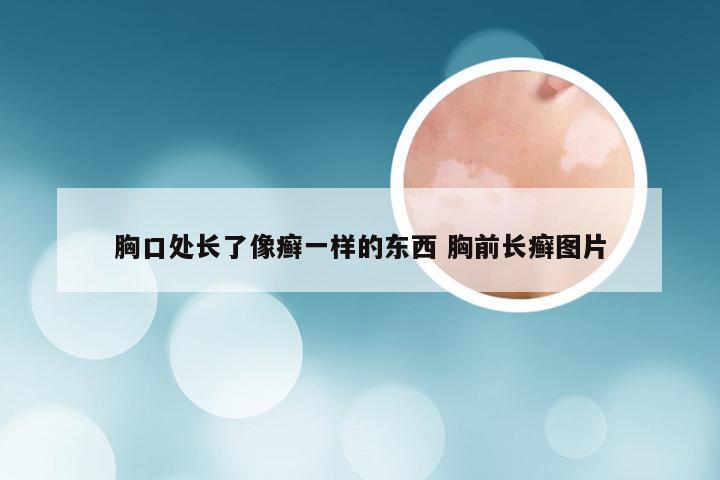 胸口处长了像癣一样的东西 胸前长癣图片