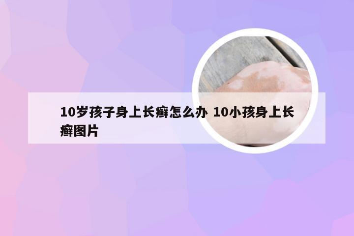 10岁孩子身上长癣怎么办 10小孩身上长癣图片