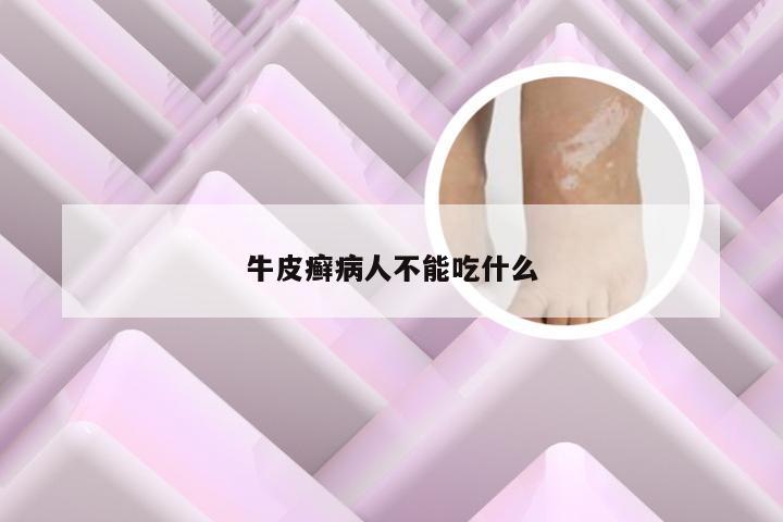 牛皮癣病人不能吃什么
