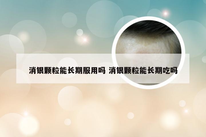 消银颗粒能长期服用吗 消银颗粒能长期吃吗