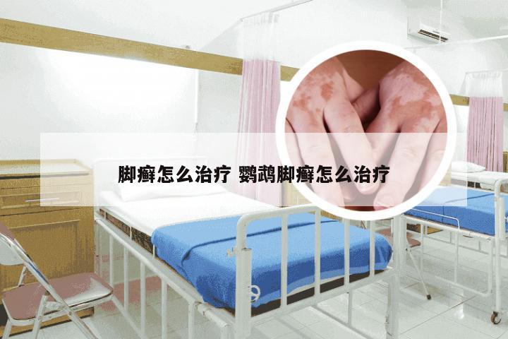 脚癣怎么治疗 鹦鹉脚癣怎么治疗