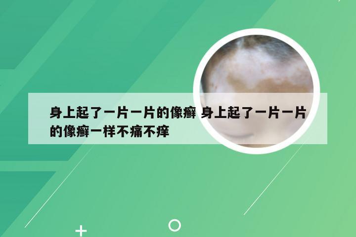 身上起了一片一片的像癣 身上起了一片一片的像癣一样不痛不痒