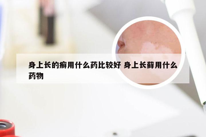 身上长的癣用什么药比较好 身上长藓用什么药物