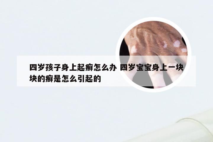 四岁孩子身上起癣怎么办 四岁宝宝身上一块块的癣是怎么引起的