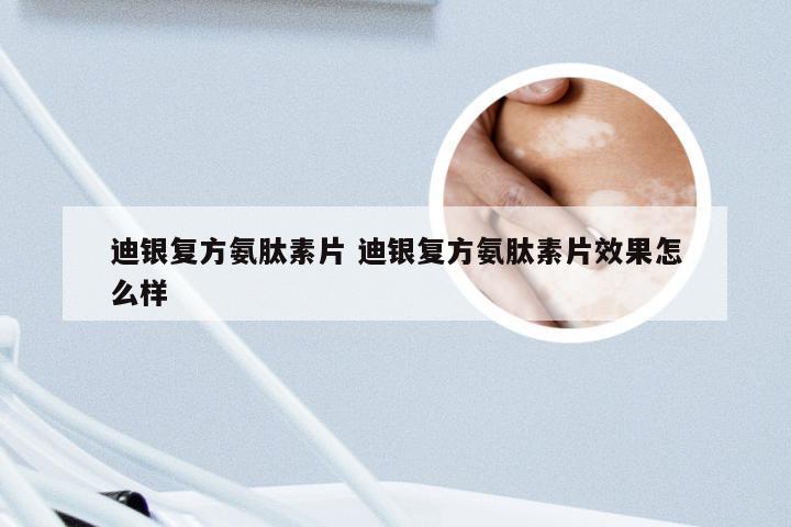 迪银复方氨肽素片 迪银复方氨肽素片效果怎么样