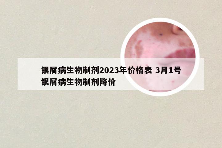 银屑病生物制剂2023年价格表 3月1号银屑病生物制剂降价