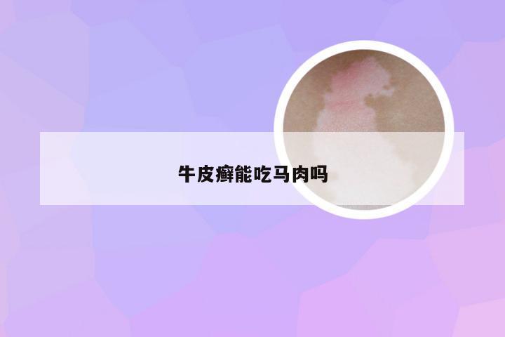 牛皮癣能吃马肉吗