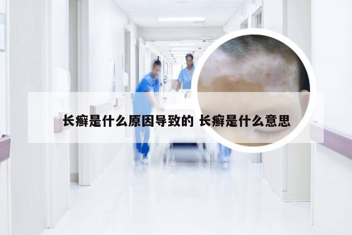 长癣是什么原因导致的 长癣是什么意思