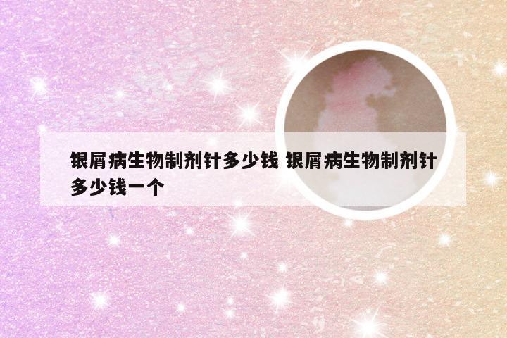银屑病生物制剂针多少钱 银屑病生物制剂针多少钱一个