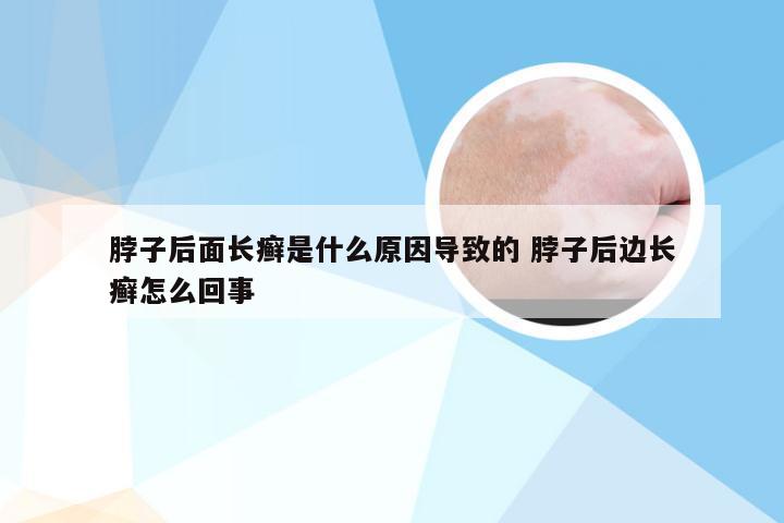 脖子后面长癣是什么原因导致的 脖子后边长癣怎么回事