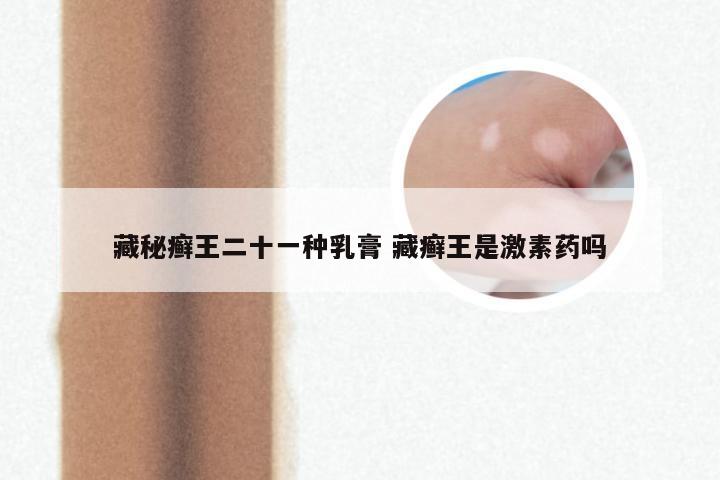 藏秘癣王二十一种乳膏 藏癣王是激素药吗