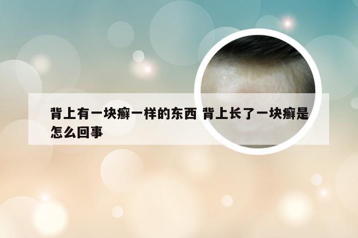背上有一块癣一样的东西 背上长了一块癣是怎么回事