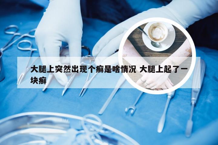 大腿上突然出现个癣是啥情况 大腿上起了一块癣