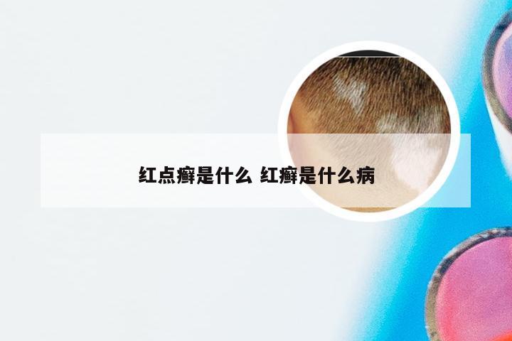 红点癣是什么 红癣是什么病