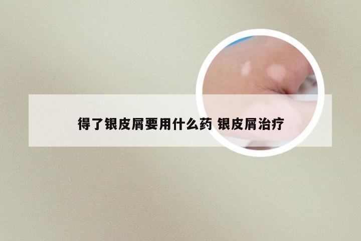 得了银皮屑要用什么药 银皮屑治疗