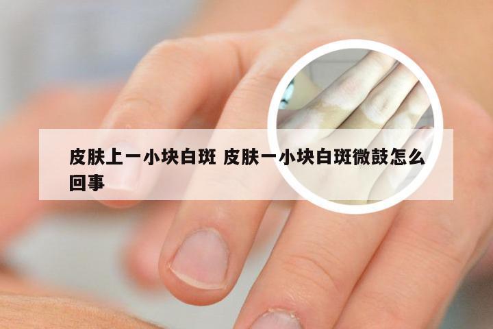 皮肤上一小块白斑 皮肤一小块白斑微鼓怎么回事
