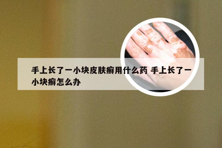 手上长了一小块皮肤癣用什么药 手上长了一小块癣怎么办