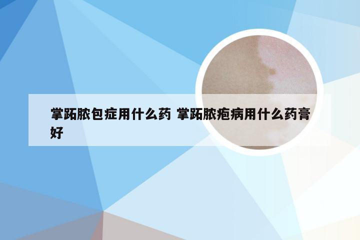 掌跖脓包症用什么药 掌跖脓疱病用什么药膏好