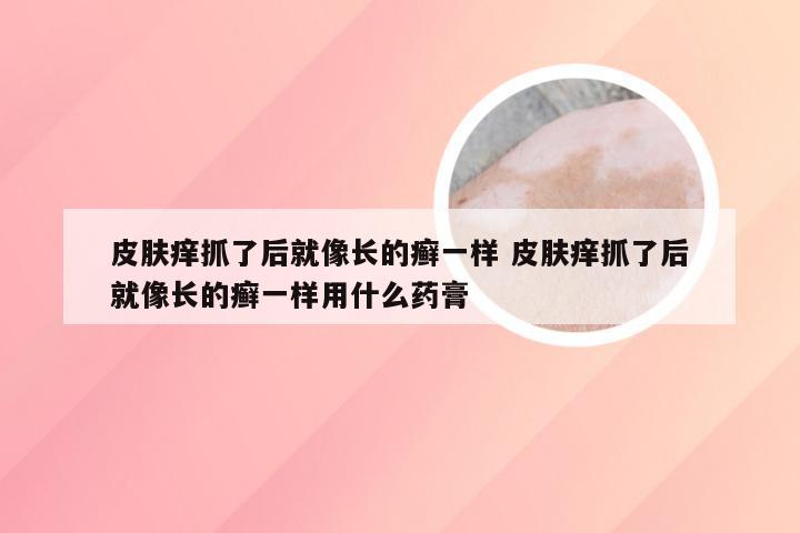 皮肤痒抓了后就像长的癣一样 皮肤痒抓了后就像长的癣一样用什么药膏