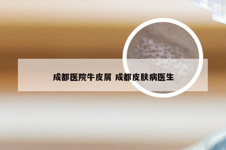 成都医院牛皮屑 成都皮肤病医生