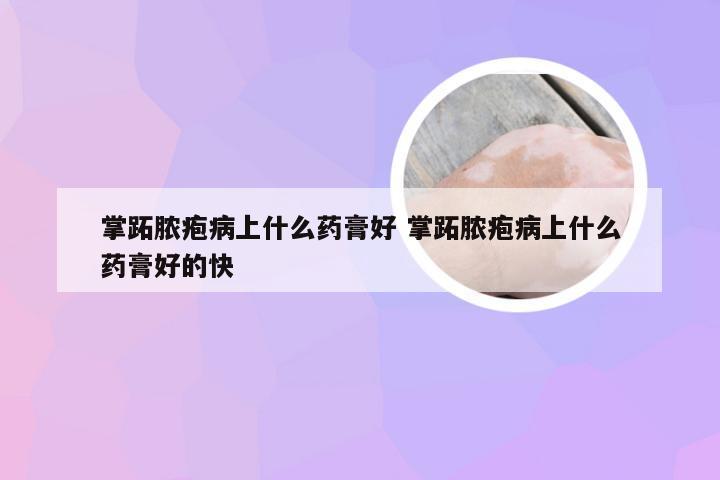 掌跖脓疱病上什么药膏好 掌跖脓疱病上什么药膏好的快