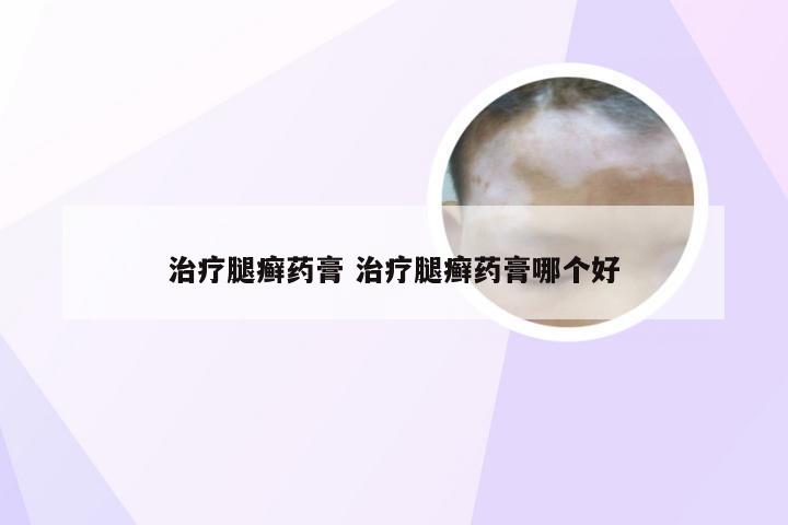 治疗腿癣药膏 治疗腿癣药膏哪个好
