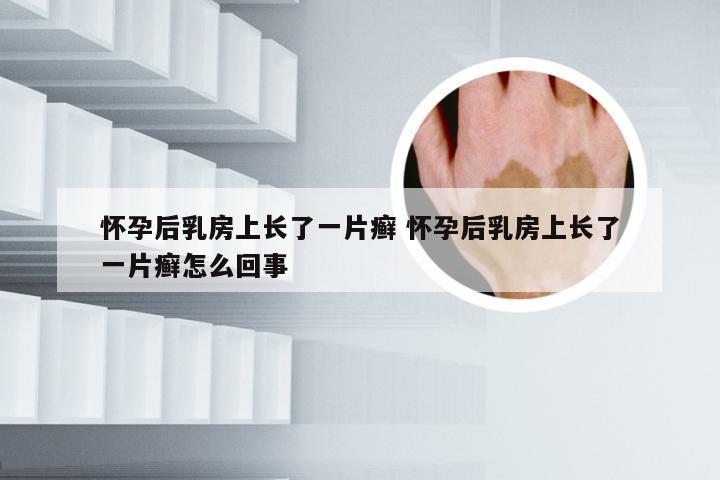 怀孕后乳房上长了一片癣 怀孕后乳房上长了一片癣怎么回事