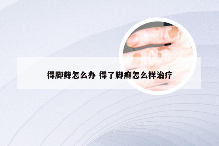得脚藓怎么办 得了脚癣怎么样治疗
