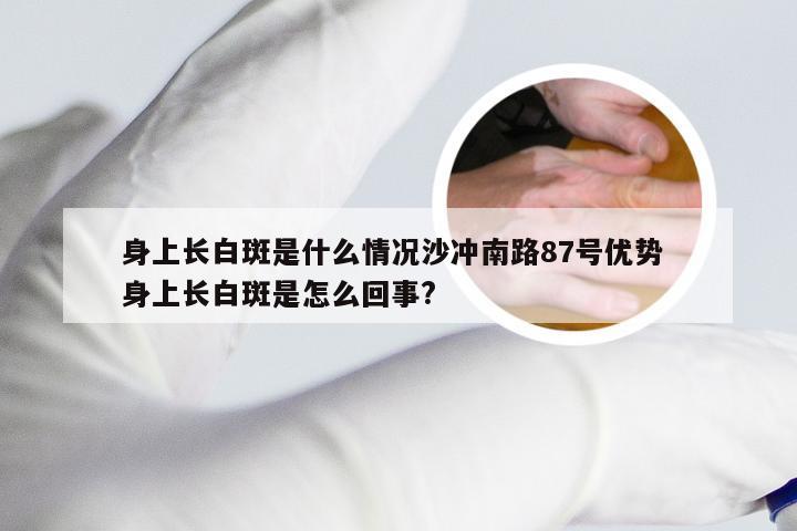 身上长白斑是什么情况沙冲南路87号优势 身上长白斑是怎么回事?