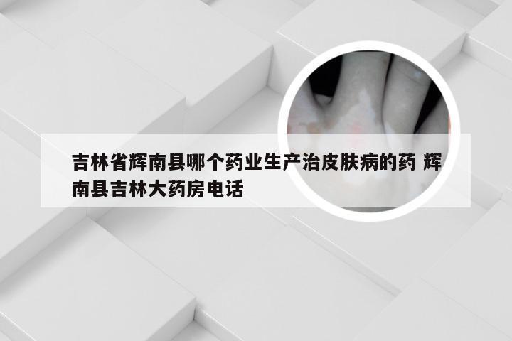 吉林省辉南县哪个药业生产治皮肤病的药 辉南县吉林大药房电话