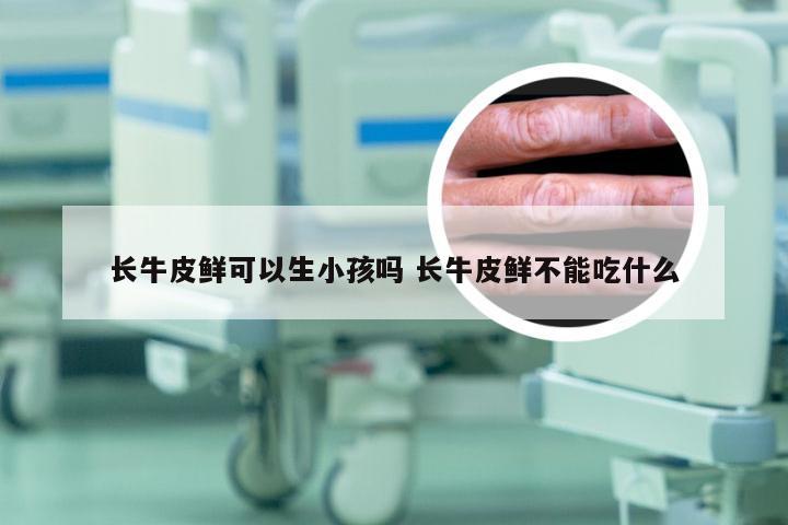 长牛皮鲜可以生小孩吗 长牛皮鲜不能吃什么