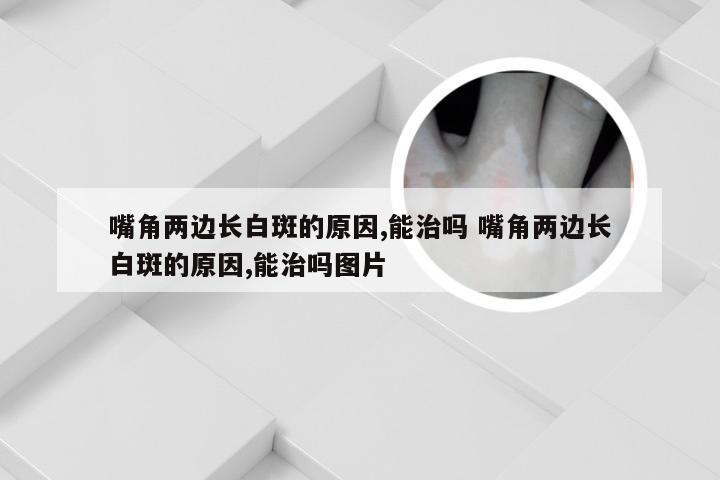 嘴角两边长白斑的原因,能治吗 嘴角两边长白斑的原因,能治吗图片