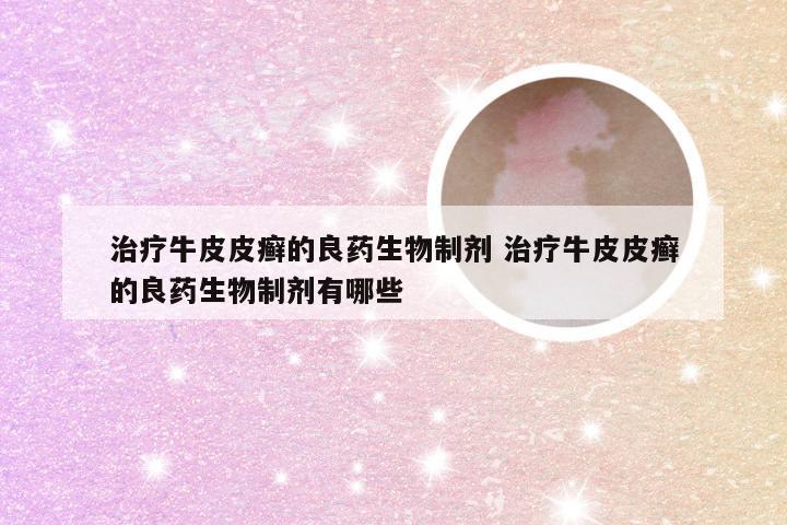 治疗牛皮皮癣的良药生物制剂 治疗牛皮皮癣的良药生物制剂有哪些