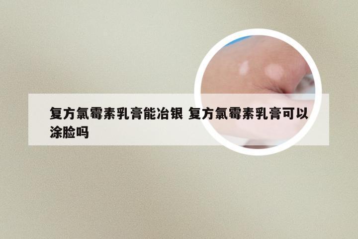 复方氯霉素乳膏能冶银 复方氯霉素乳膏可以涂脸吗