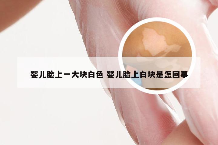 婴儿脸上一大块白色 婴儿脸上白块是怎回事