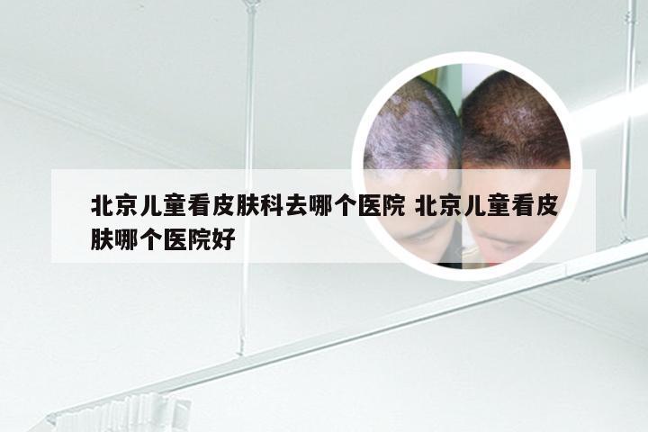 北京儿童看皮肤科去哪个医院 北京儿童看皮肤哪个医院好