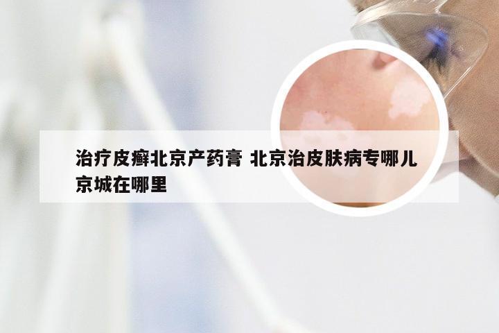 治疗皮癣北京产药膏 北京治皮肤病专哪儿 京城在哪里