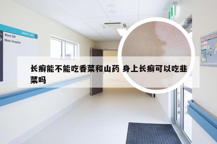 长癣能不能吃香菜和山药 身上长癣可以吃韭菜吗