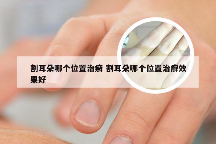 割耳朵哪个位置治癣 割耳朵哪个位置治癣效果好