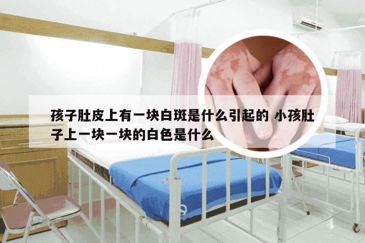 孩子肚皮上有一块白斑是什么引起的 小孩肚子上一块一块的白色是什么